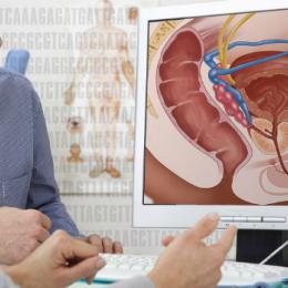 Pesquisadores israelenses descobrem tratamento para câncer de próstata