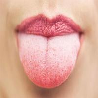 Saúde bucal – Muito importante deixar nossa boca sempre limpa