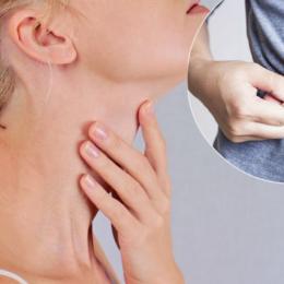 Hipotireoidismo: 10 sinais de que você pode ter a doença 