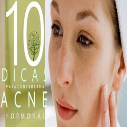 10 dicas para controlar o acne hormonal 