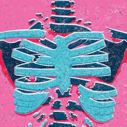 Salve o esqueleto: como prevenir a osteoporose e as fraturas
