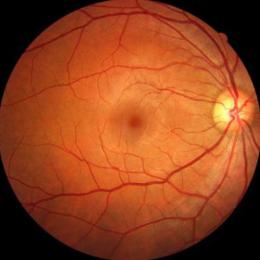 Cientistas criaram uma retina humana do zero no laboratório