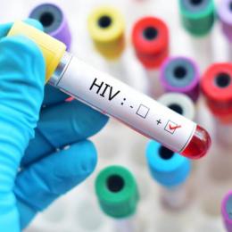 Cientistas relatam segundo caso de cura do HIV após transplante
