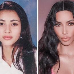 10 celebridades que eram mais bonitas antes de fazer cirurgias plásticas