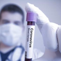 Há casos de novo coronavírus em 47 países dos cinco continentes