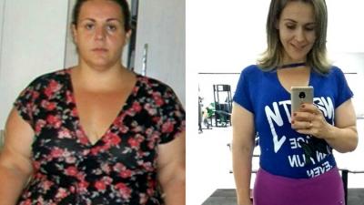 Mulher emagrece 65 kg por conta própria após perder celular nas dobras da barriga