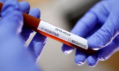 Covid-19: Nova Trento tem quinto caso confirmado de coronavírus