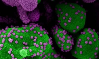 Pessoas que contraíram vírus de resfriado comum podem ganhar imunidade à Covid-19, diz estudo