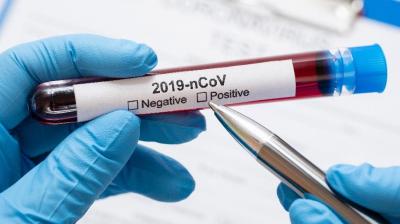 Cientistas da USP desenvolvem teste mais simples, barato e rápido para detectar coronavírus