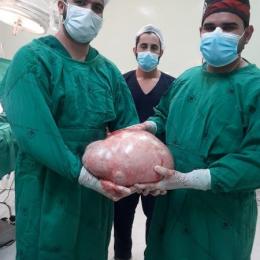 Não era gravidez: jovem retira tumor de 20 kg do ovário