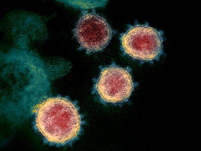 Estudos feitos no Nordeste analisam resposta imune à Covid-19