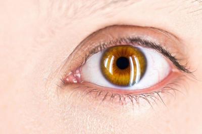 Cientistas australianos criam olho biônico com técnica pioneira