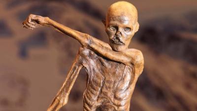 A extensa lista dos problemas de saúde de Ötzi, o famoso Homem de Gelo