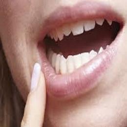 12 doenças que se manifestam pela boca: como identificar?