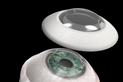 Córnea sintética devolve visão a paciente cego