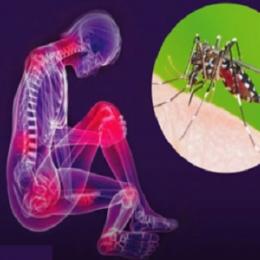  Guia completo de informações sobre a chikungunya