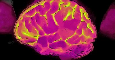 Proteína identificada por cientistas aponta células do cérebro com maior risco de Alzheimer