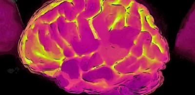 Proteína é capaz de apontar células do cérebro com maior risco de Alzheimer