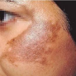  8 doenças sérias sinalizadas pela nossa pele