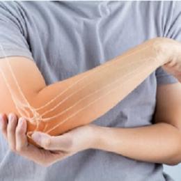  Um novo e inovador tratamento para quem tem artrite reumatoide