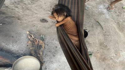 ABANDONADOS: Índios yanomamis estão morrendo desnutridos por falta de assistência médica