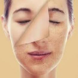  O que realmente funciona para clarear a pele?