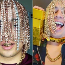 Rapper mexicano implanta correntes de ouro na cabeça