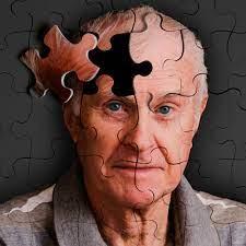 Sinais precoces de demência podem surgir até 18 anos antes do diagnóstico