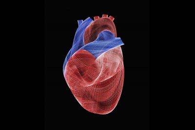 Médica alerta para doença cardíaca que leva mulheres jovens a infartar