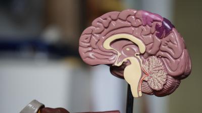 Viagra pode ajudar a prevenir Alzheimer, diz nova pesquisa