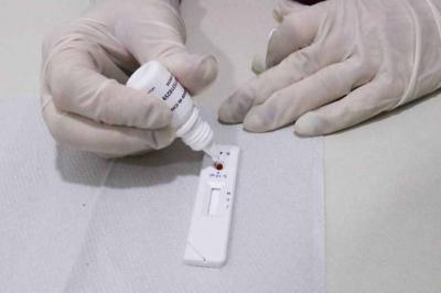 Comunicado sobre exame RT-PCR em Aracaju