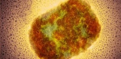 EUA registram primeiro caso de infecção por varíola dos macacos