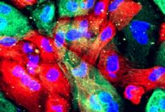 Novo tratamento de câncer de próstata NanoKnife usa eletricidade e mata células cancerosas
