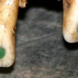 Antiga prática maia de colar pedras preciosas nos dentes pode ter sido mais que estética