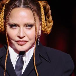 Madonna debate crítica sobre rosto inchado