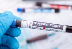 OMS publica informe sobre risco de espalhamento do vírus Marburg