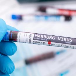 OMS publica informe sobre risco de espalhamento do vírus Marburg