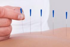 Conheça essas 4 curiosidades sobre a acupuntura?