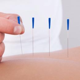Conheça essas 4 curiosidades sobre a acupuntura?