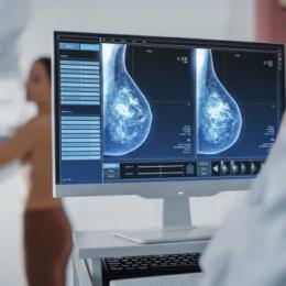 42% das mulheres nunca fizeram mamografia por se considerarem jovens