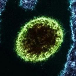 Vírus Nipah, existe risco de uma nova pandemia?