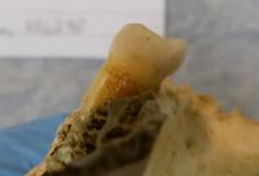 Cientistas extraem genes de dentes de 4000 anos para iluminar impacto na dieta humana