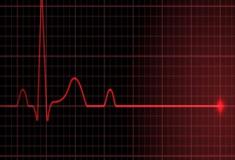 Parada cardíaca: O que é, causas e consequências
