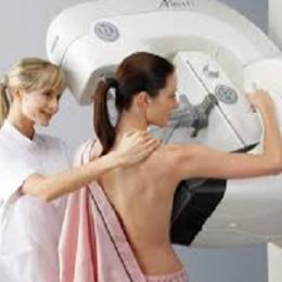  Mamografia - tudo o que você deve e precisa saber