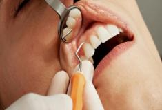 Má higiene oral pode desenvolver diversas doenças, entenda