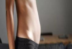 Estômago alto? Veja 5 causas comuns para a barriga inchada