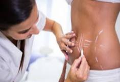 Lipoaspiração - mitos, verdades e mentiras
