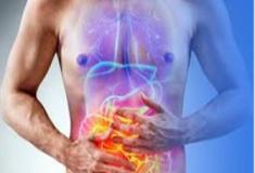 Doença de Crohn - inflamação crônica do trato gastrointestinal