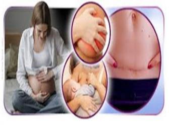6 cuidados fundamentais que a mulher deve ter após o parto