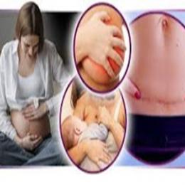 6 cuidados fundamentais que a mulher deve ter após o parto